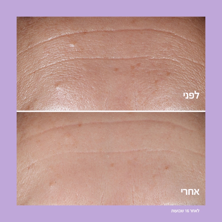 Smart Clinical RepairTM Wrinkle Correcting Serum