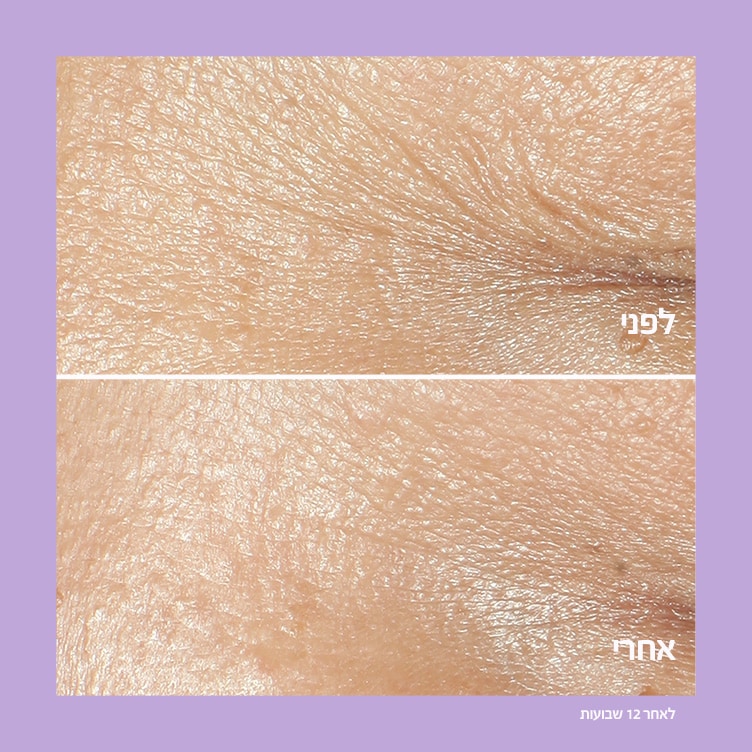 Smart Clinical RepairTM Wrinkle Correcting Cream