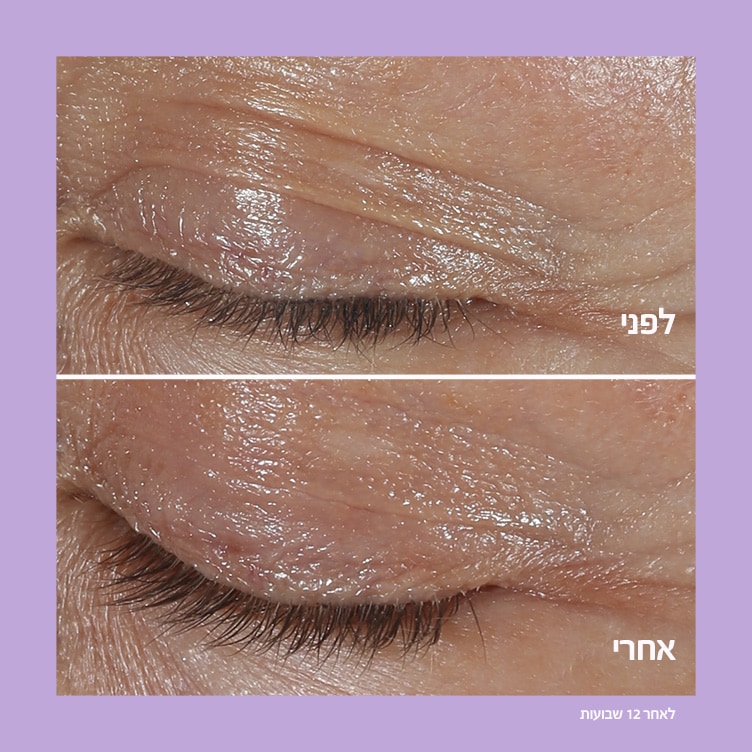 Smart Clinical RepairTM Eye Cream